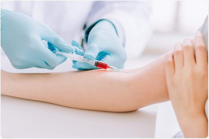 How Do Professionals Ensure Safe Blood Test at Home?