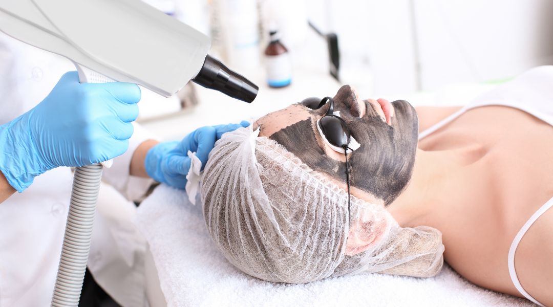 What to Expect During a Laser Carbon Peel Session
